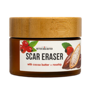 scar cream, scar butter with cocoa butter and rosehip oil